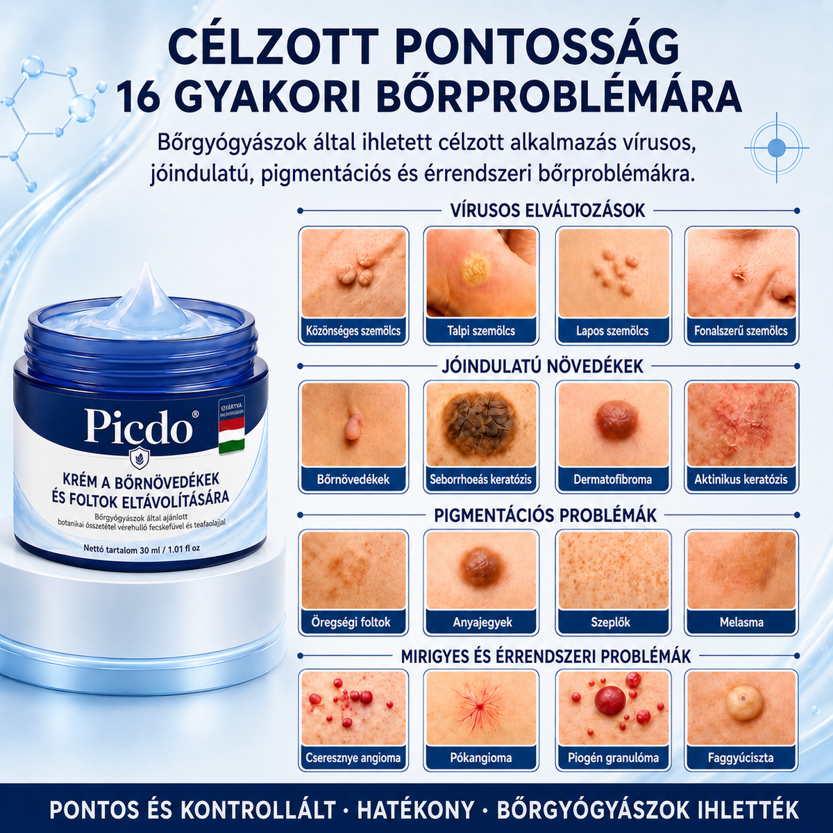 👨‍⚕️🌼𝐏𝐢𝐜𝐝𝐨® 𝟕 𝐧𝐚𝐩 𝐒𝐳𝐞𝐦ö𝐥𝐜𝐬- é𝐬 𝐟𝐨𝐥𝐭𝐞𝐥𝐭á𝐯𝐨𝐥í𝐭ó 𝐤𝐫é𝐦🩵 (Zero Pain, Zero 𝐒𝐜𝐚𝐫𝐬 Formula)