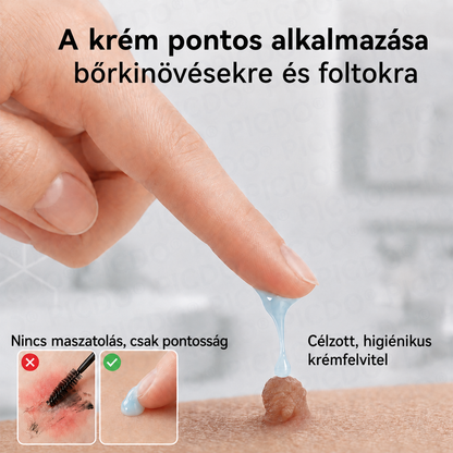 👨‍⚕️🌼𝐏𝐢𝐜𝐝𝐨® 𝟕 𝐧𝐚𝐩 𝐒𝐳𝐞𝐦ö𝐥𝐜𝐬- é𝐬 𝐟𝐨𝐥𝐭𝐞𝐥𝐭á𝐯𝐨𝐥í𝐭ó 𝐤𝐫é𝐦🩵 (Zero Pain, Zero 𝐒𝐜𝐚𝐫𝐬 Formula)