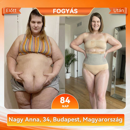 🍏Hivatalos márkabolt |👩‍⚕️ 𝐏𝐀𝐔𝐑𝐀𝐉𝐔® 𝟐𝟎𝟐𝟔 𝐌𝐨𝐫𝐢𝐧𝐠𝐚 É𝐬 𝐁𝐞𝐫𝐛𝐞𝐫𝐢𝐧 𝟒 𝐀𝐳 𝟏-𝐁𝐞𝐧 𝐌𝐢𝐤𝐫𝐨𝐫é𝐬𝐳𝐞𝐜𝐬𝐤é𝐬 𝐀𝐥𝐚𝐤𝐟𝐨𝐫𝐦á𝐥ó É𝐬 𝐙𝐬í𝐫é𝐠𝐞𝐭ó 𝐑ö𝐯𝐢𝐝𝐧𝐚𝐝𝐫á𝐠