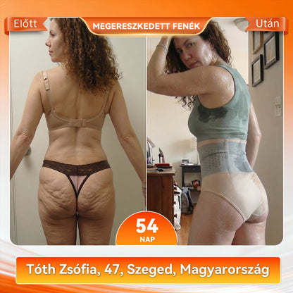 🍏Hivatalos márkabolt |👩‍⚕️ 𝐏𝐀𝐔𝐑𝐀𝐉𝐔® 𝟐𝟎𝟐𝟔 𝐌𝐨𝐫𝐢𝐧𝐠𝐚 É𝐬 𝐁𝐞𝐫𝐛𝐞𝐫𝐢𝐧 𝟒 𝐀𝐳 𝟏-𝐁𝐞𝐧 𝐌𝐢𝐤𝐫𝐨𝐫é𝐬𝐳𝐞𝐜𝐬𝐤é𝐬 𝐀𝐥𝐚𝐤𝐟𝐨𝐫𝐦á𝐥ó É𝐬 𝐙𝐬í𝐫é𝐠𝐞𝐭ó 𝐑ö𝐯𝐢𝐝𝐧𝐚𝐝𝐫á𝐠