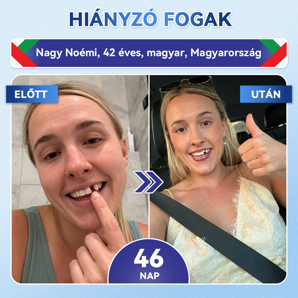 🎊𝐆𝐥𝐢𝐦𝐦𝐞𝐫𝐥𝐲® 🦷 Tideglusib Fog & íny Javító mikrotűs tapasz | Fejlett őssejt-aktiváló fogcsíkok (újjáépíti a fogzománcot és a dentint • erősíti az ínyt • megszünteti a fogkövet és a szagokat • megállítja a fogérzékenységet) 3.0 🌻 (Copy)