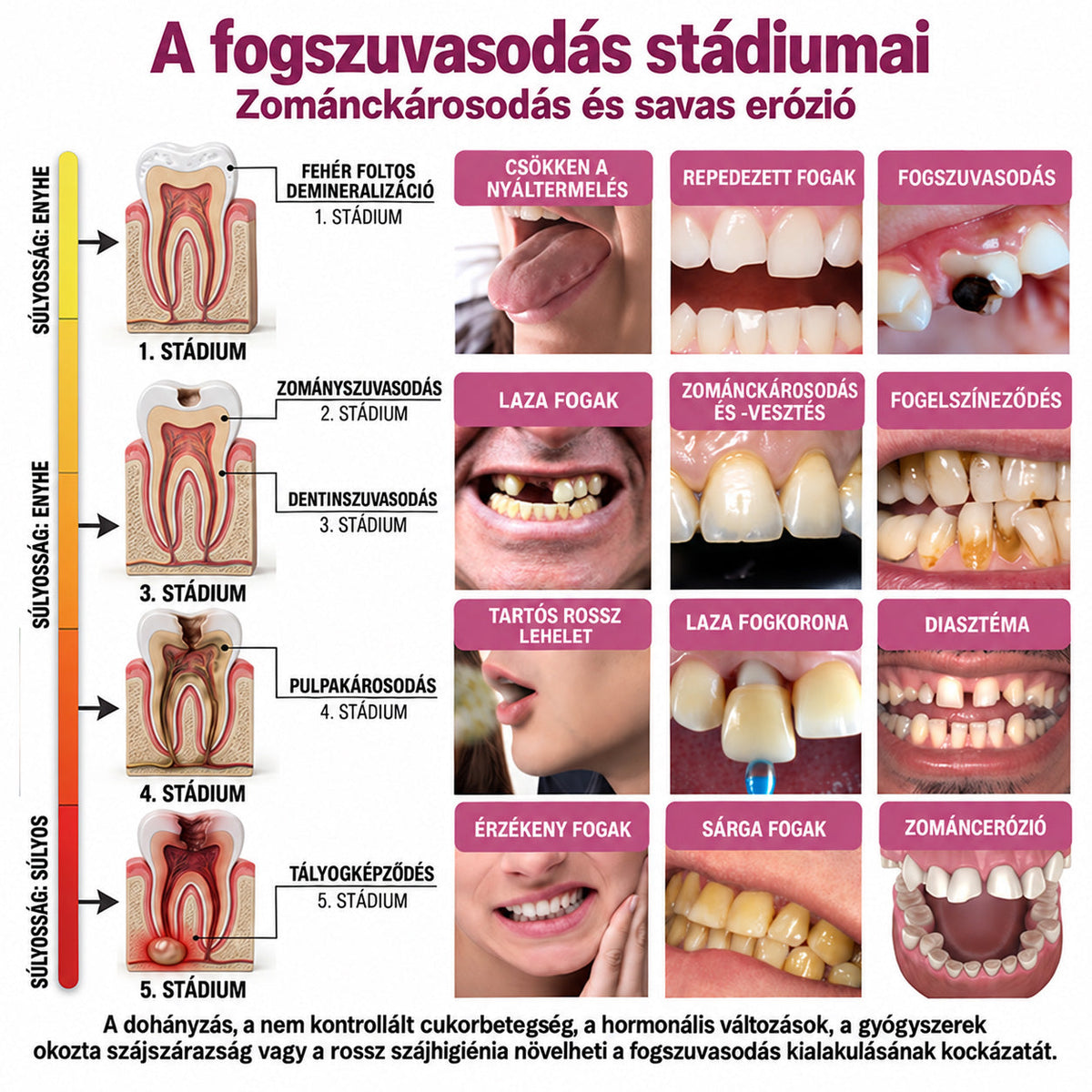 ⭐👨‍⚕️🦷HEATWOLF® DenPerm – Természetes fogzománc-töltő gél a fogszuvasodás helyreállítására🐟1️⃣