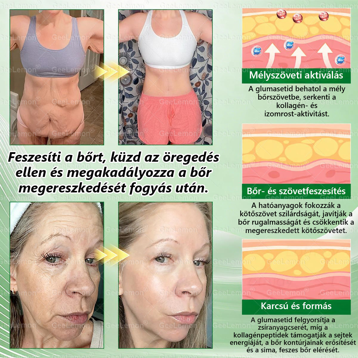 🍧Hivatalos tanúsítás🔥 Több ezer elégedett felhasználó Magyarországon| 🤍𝐆𝐞𝑒𝐿𝑒𝐦𝐨𝐧® Glumasetide 10 az 1-ben Karcsú és Egészséges Nano Mikrotűs Tapasz 🇭🇺