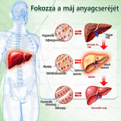 🍧Hivatalos tanúsítás🔥 Több ezer elégedett felhasználó Magyarországon| 🤍𝐆𝐞𝑒𝐿𝑒𝐦𝐨𝐧® Glumasetide 10 az 1-ben Karcsú és Egészséges Nano Mikrotűs Tapasz 🇭🇺