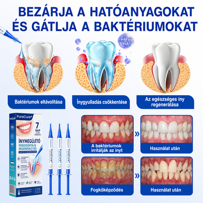 🦷🥑𝑮𝒍𝒊𝒎𝒎𝒆𝒓𝒍𝒚®  ÍNYMEGÚJÍTÓ – Parodontális helyreállító gél