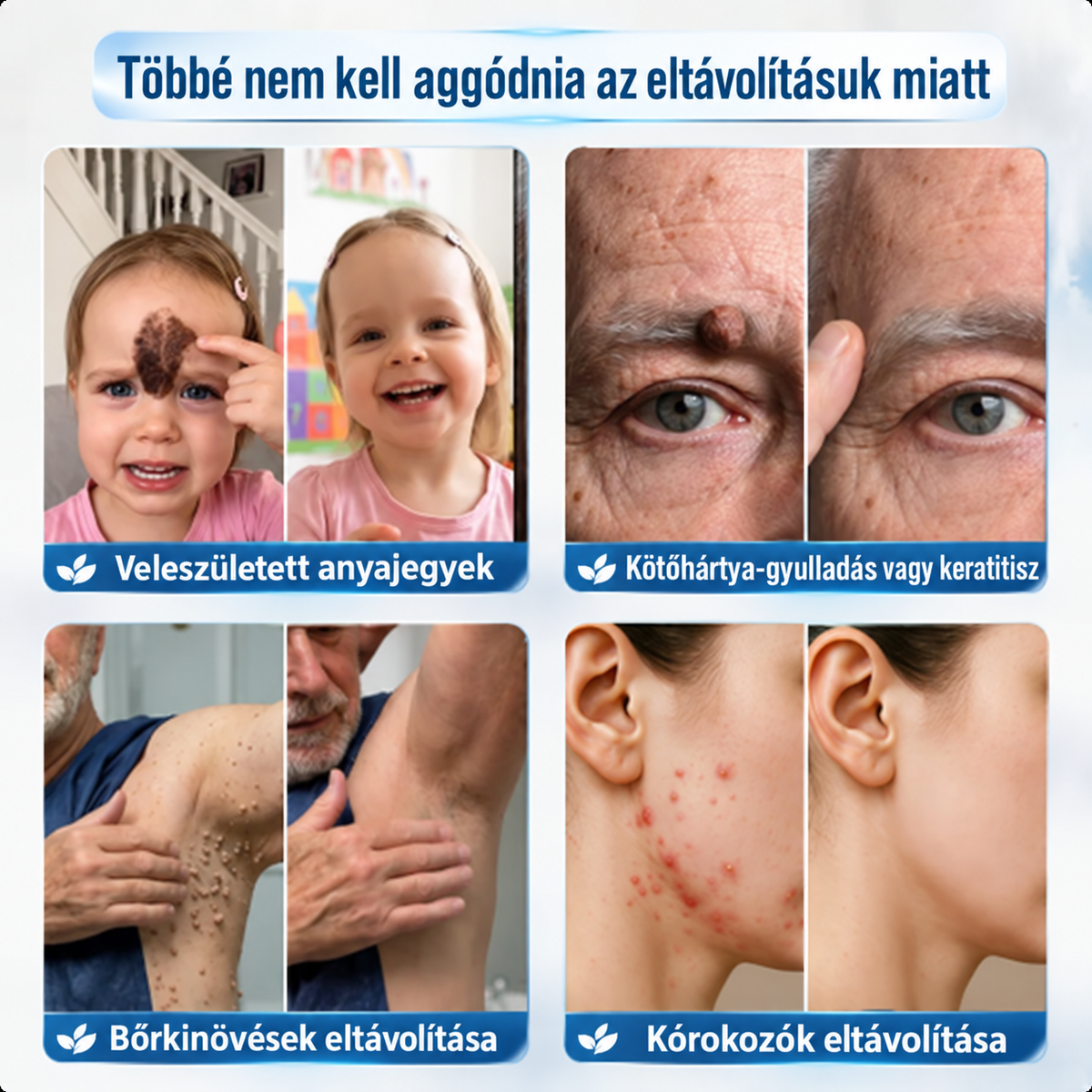 👨‍⚕️🌼𝐏𝐢𝐜𝐝𝐨® 𝟕 𝐧𝐚𝐩 𝐒𝐳𝐞𝐦ö𝐥𝐜𝐬- é𝐬 𝐟𝐨𝐥𝐭𝐞𝐥𝐭á𝐯𝐨𝐥í𝐭ó 𝐤𝐫é𝐦🩵 (Zero Pain, Zero 𝐒𝐜𝐚𝐫𝐬 Formula)