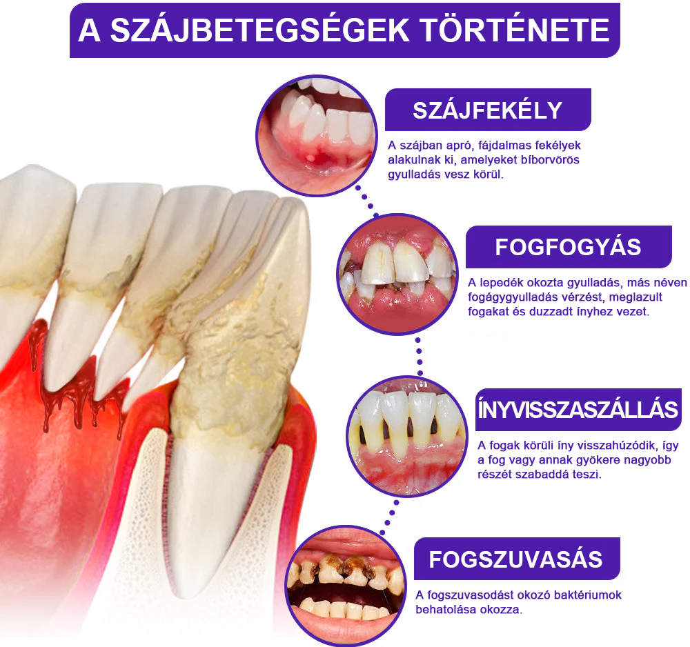 🧊Rolimey® VioCore Méhméreg Fogkezelő Fogkrém- 🛒