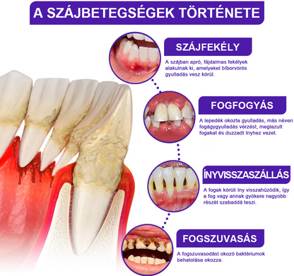 🧊Rolimey® VioCore Méhméreg Fogkezelő Fogkrém- 🛒