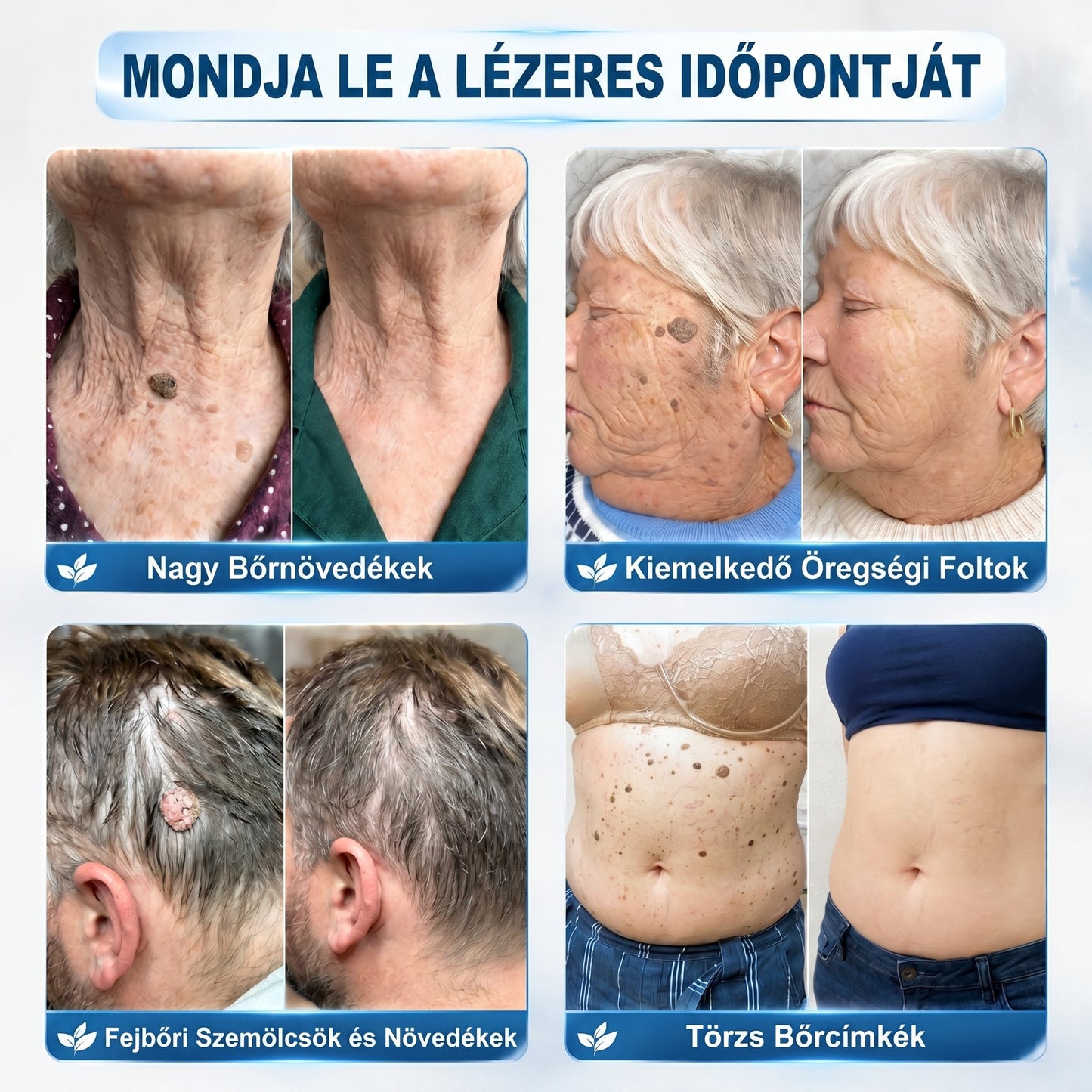 🌼𝐇𝐢𝐯𝐚𝐭𝐚𝐥𝐨𝐬 𝐦á𝐫𝐤𝐚𝐛𝐨𝐥𝐭  𝐏𝐢𝐜𝐝𝐨®   𝟕 𝐍𝐚𝐩𝐨𝐬 𝐁ő𝐫𝐤𝐢𝐧ö𝐯é𝐬- é𝐬 𝐅𝐨𝐥𝐭𝐫𝐚𝐝í𝐫(Fájdalommentes, nyommentes roll-on)