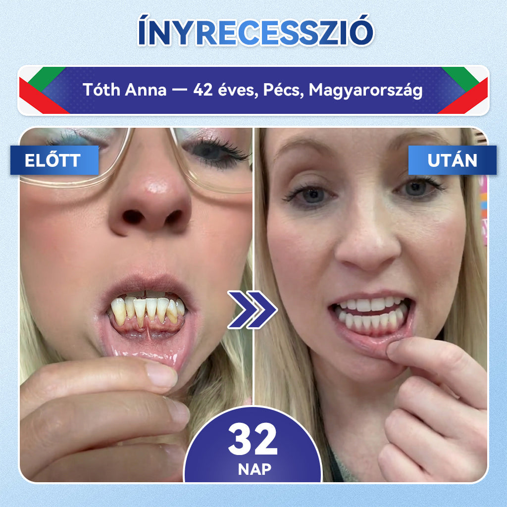 🎊𝐆𝐥𝐢𝐦𝐦𝐞𝐫𝐥𝐲® 🦷 Tideglusib Fog & íny Javító mikrotűs tapasz | Fejlett őssejt-aktiváló fogcsíkok (újjáépíti a fogzománcot és a dentint • erősíti az ínyt • megszünteti a fogkövet és a szagokat • megállítja a fogérzékenységet) 3.0 🌻 (Copy)