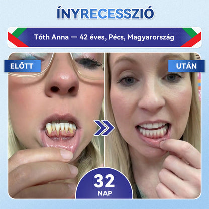 🎊𝐆𝐥𝐢𝐦𝐦𝐞𝐫𝐥𝐲® 🦷 Tideglusib Fog & íny Javító mikrotűs tapasz | Fejlett őssejt-aktiváló fogcsíkok (újjáépíti a fogzománcot és a dentint • erősíti az ínyt • megszünteti a fogkövet és a szagokat • megállítja a fogérzékenységet) 3.0 🌻 (Copy)