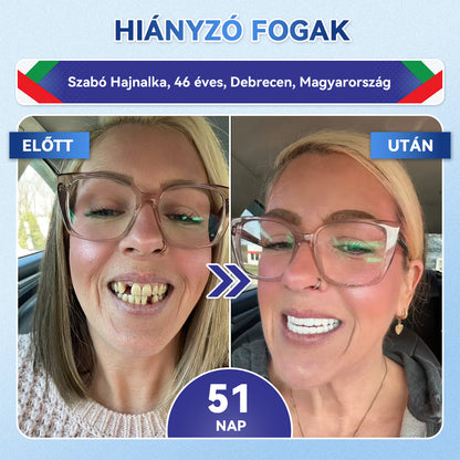 🎊𝐆𝐥𝐢𝐦𝐦𝐞𝐫𝐥𝐲® 🦷 Tideglusib Fog & íny Javító mikrotűs tapasz | Fejlett őssejt-aktiváló fogcsíkok (újjáépíti a fogzománcot és a dentint • erősíti az ínyt • megszünteti a fogkövet és a szagokat • megállítja a fogérzékenységet) 3.0 🌻 (Copy)