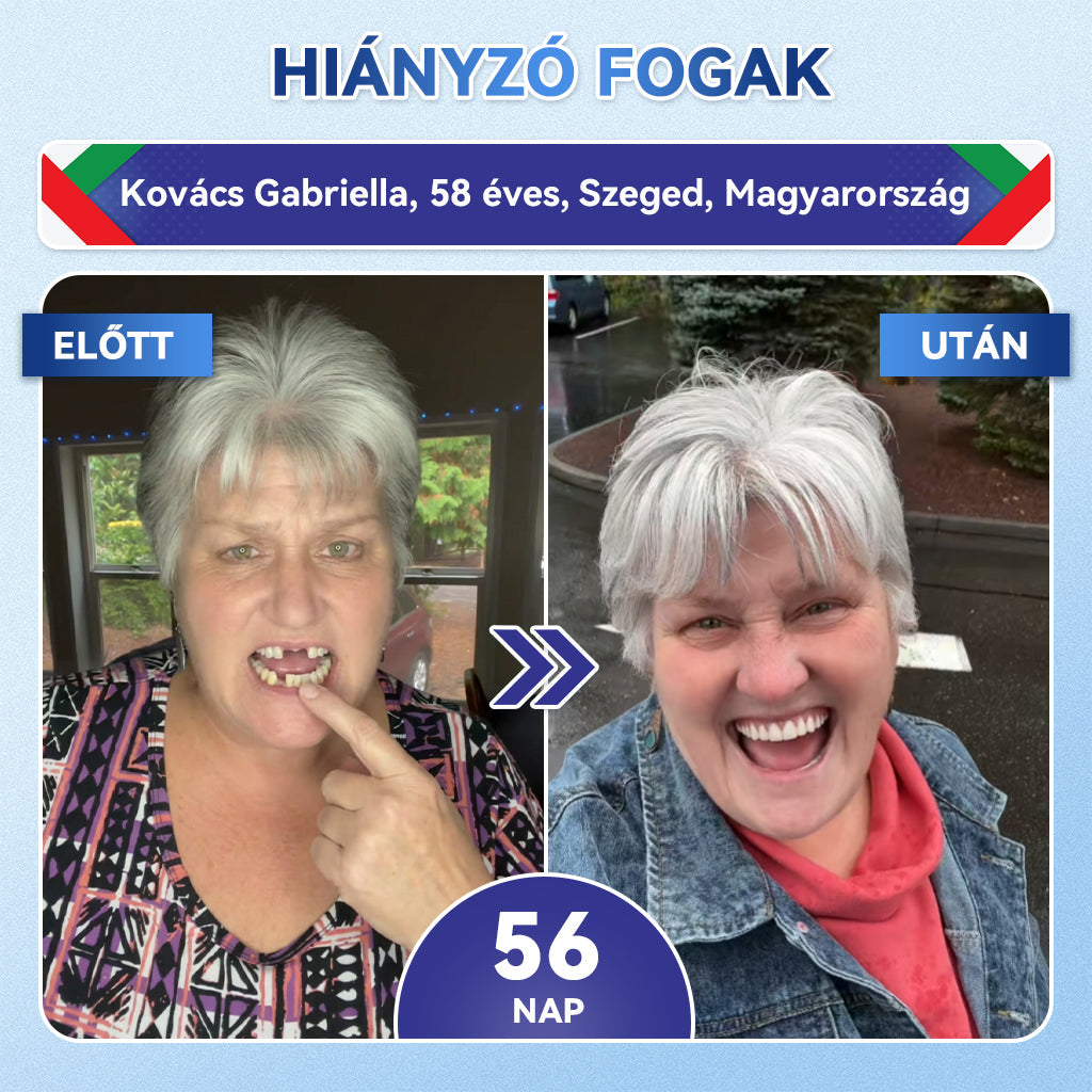 🎊𝐆𝐥𝐢𝐦𝐦𝐞𝐫𝐥𝐲® 🦷 Tideglusib Fog & íny Javító mikrotűs tapasz | Fejlett őssejt-aktiváló fogcsíkok (újjáépíti a fogzománcot és a dentint • erősíti az ínyt • megszünteti a fogkövet és a szagokat • megállítja a fogérzékenységet) 3.0 🌻 (Copy)