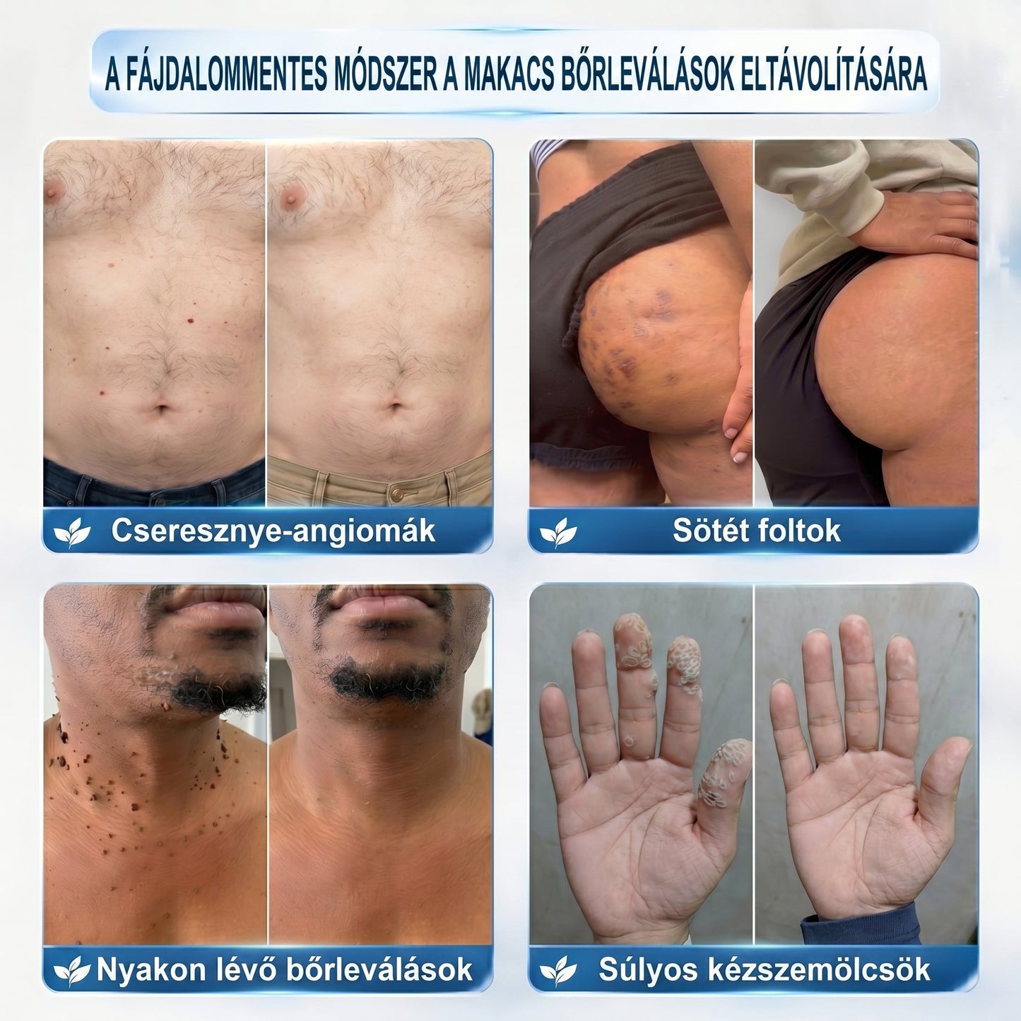 🌼𝐇𝐢𝐯𝐚𝐭𝐚𝐥𝐨𝐬 𝐦á𝐫𝐤𝐚𝐛𝐨𝐥𝐭  𝐏𝐢𝐜𝐝𝐨®   𝟕 𝐍𝐚𝐩𝐨𝐬 𝐁ő𝐫𝐤𝐢𝐧ö𝐯é𝐬- é𝐬 𝐅𝐨𝐥𝐭𝐫𝐚𝐝í𝐫(Fájdalommentes, nyommentes roll-on)