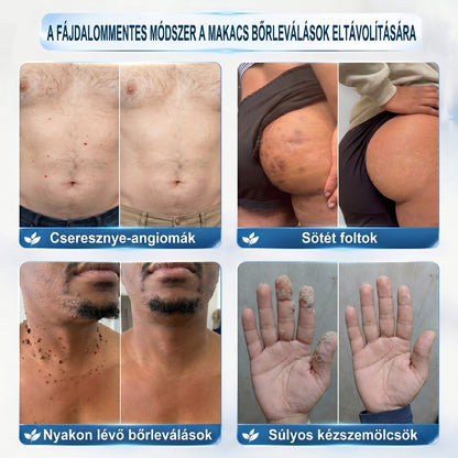 🌼𝐇𝐢𝐯𝐚𝐭𝐚𝐥𝐨𝐬 𝐦á𝐫𝐤𝐚𝐛𝐨𝐥𝐭  𝐏𝐢𝐜𝐝𝐨®   𝟕 𝐍𝐚𝐩𝐨𝐬 𝐁ő𝐫𝐤𝐢𝐧ö𝐯é𝐬- é𝐬 𝐅𝐨𝐥𝐭𝐫𝐚𝐝í𝐫(Fájdalommentes, nyommentes roll-on)