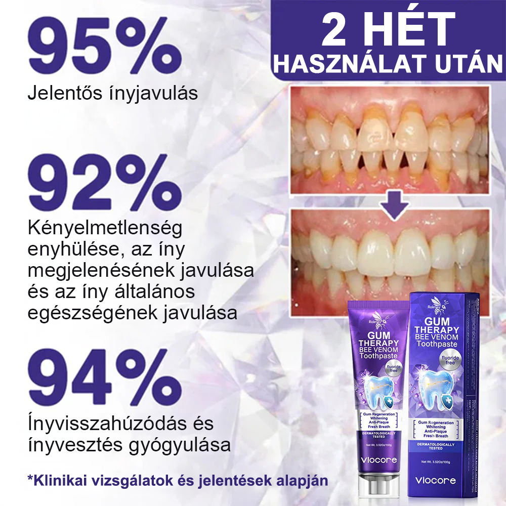 🧊Rolimey® VioCore Méhméreg Fogkezelő Fogkrém- 🛒