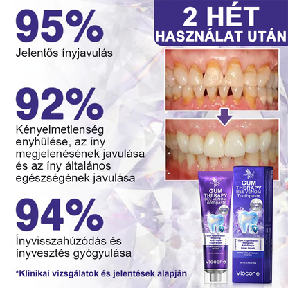 🧊Rolimey® VioCore Méhméreg Fogkezelő Fogkrém- 🛒