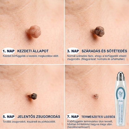 🌼𝐇𝐢𝐯𝐚𝐭𝐚𝐥𝐨𝐬 𝐦á𝐫𝐤𝐚𝐛𝐨𝐥𝐭  𝐏𝐢𝐜𝐝𝐨®   𝟕 𝐍𝐚𝐩𝐨𝐬 𝐁ő𝐫𝐤𝐢𝐧ö𝐯é𝐬- é𝐬 𝐅𝐨𝐥𝐭𝐫𝐚𝐝í𝐫(Fájdalommentes, nyommentes roll-on)