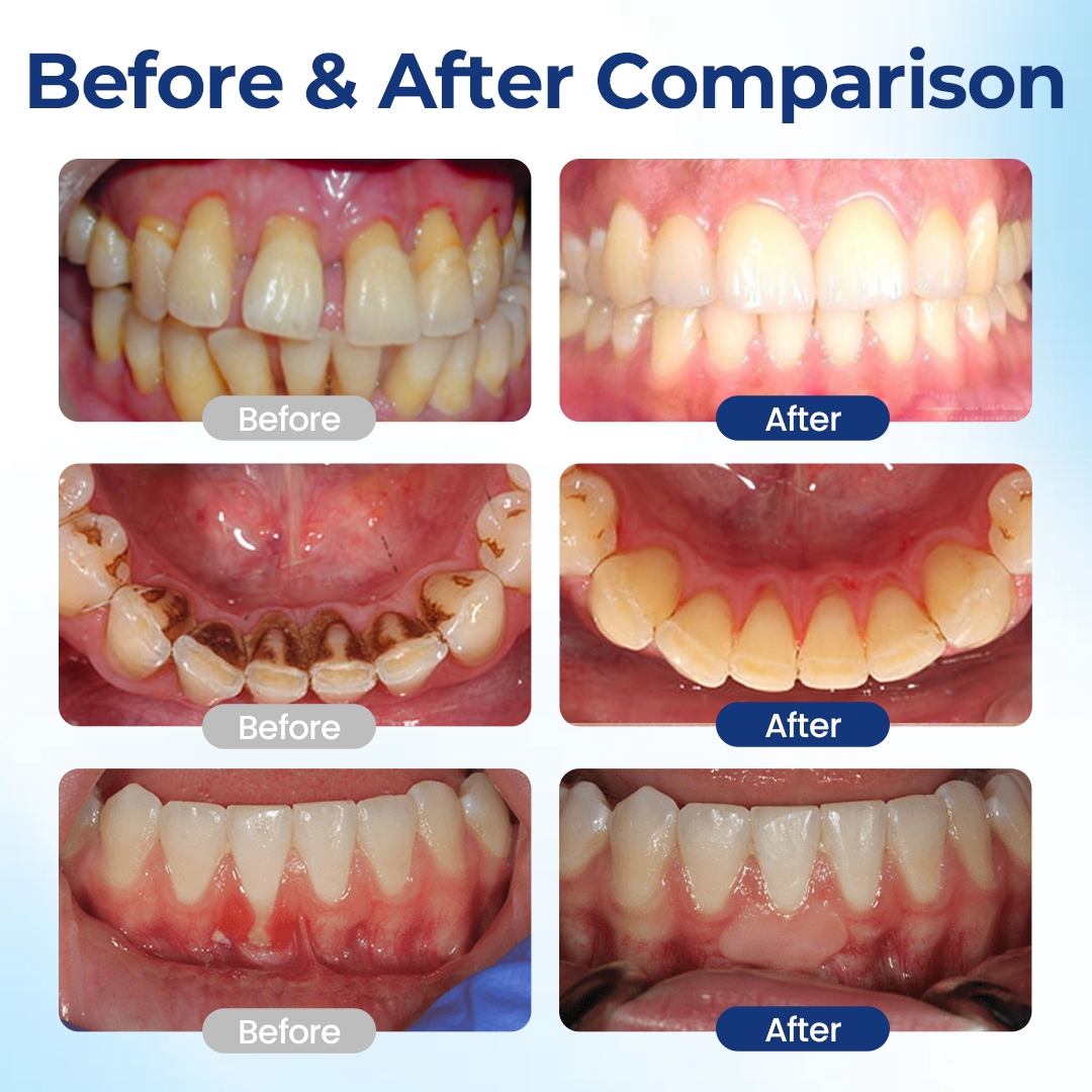🧲 Biancat® BeeTakt Oral Repair Solution Klinikai ihletésű méhméreg-alapú szájápolási technológia az íny egészségéért és a szájüregi szövetek regenerációjáért