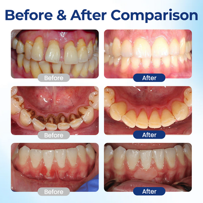 🧲 Biancat® BeeTakt Oral Repair Solution Klinikai ihletésű méhméreg-alapú szájápolási technológia az íny egészségéért és a szájüregi szövetek regenerációjáért
