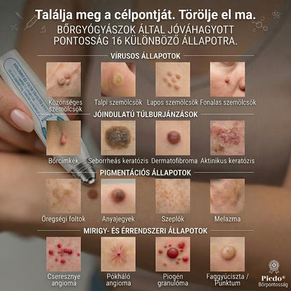 🌼𝐇𝐢𝐯𝐚𝐭𝐚𝐥𝐨𝐬 𝐦á𝐫𝐤𝐚𝐛𝐨𝐥𝐭  𝐏𝐢𝐜𝐝𝐨®   𝟕 𝐍𝐚𝐩𝐨𝐬 𝐁ő𝐫𝐤𝐢𝐧ö𝐯é𝐬- é𝐬 𝐅𝐨𝐥𝐭𝐫𝐚𝐝í𝐫(Fájdalommentes, nyommentes roll-on)