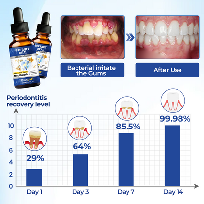 🧲 Biancat® BeeTakt Oral Repair Solution Klinikai ihletésű méhméreg-alapú szájápolási technológia az íny egészségéért és a szájüregi szövetek regenerációjáért