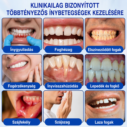 🦷🥑𝑮𝒍𝒊𝒎𝒎𝒆𝒓𝒍𝒚®  ÍNYMEGÚJÍTÓ – Parodontális helyreállító gél