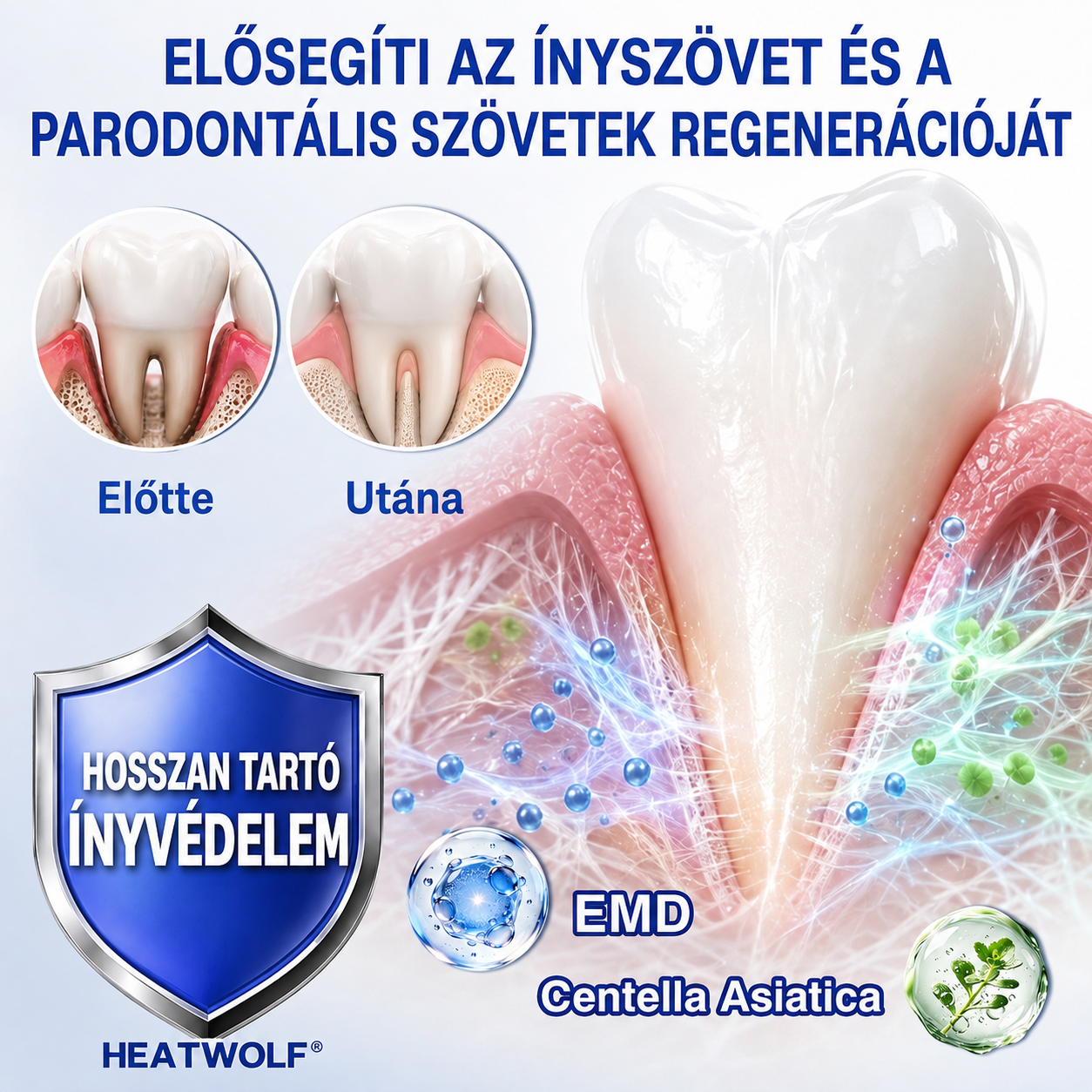 🦷🥑𝑮𝒍𝒊𝒎𝒎𝒆𝒓𝒍𝒚®  ÍNYMEGÚJÍTÓ – Parodontális helyreállító gél