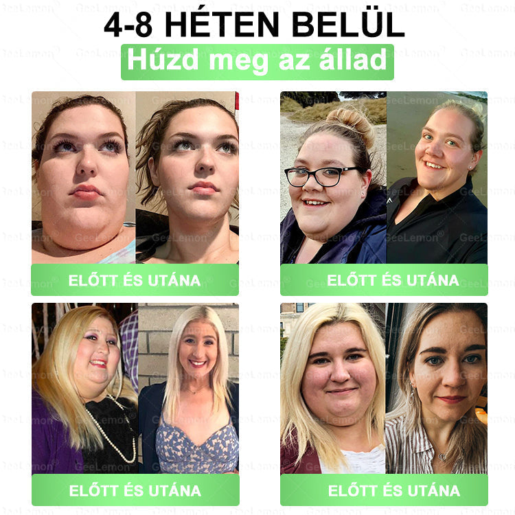 🍧Hivatalos tanúsítás🔥 Több ezer elégedett felhasználó Magyarországon| 🤍𝐆𝐞𝑒𝐿𝑒𝐦𝐨𝐧® Glumasetide 10 az 1-ben Karcsú és Egészséges Nano Mikrotűs Tapasz 🇭🇺
