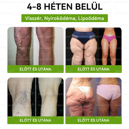🍧Hivatalos tanúsítás🔥 Több ezer elégedett felhasználó Magyarországon| 🤍𝐆𝐞𝑒𝐿𝑒𝐦𝐨𝐧® Glumasetide 10 az 1-ben Karcsú és Egészséges Nano Mikrotűs Tapasz 🇭🇺